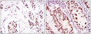 AM06582SU-N - DNA-PKcs / PRKDC / XRCC7