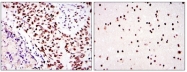 AM06582SU-N - DNA-PKcs / PRKDC / XRCC7