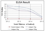 AM06592SU-N - HPV16 E7 protein