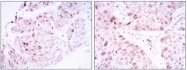 AM06594SU-N - CDK1