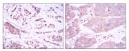 AM06595SU-N - Beclin-1