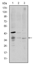 AM06598SU-N - CD1a