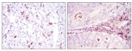AM06599SU-N - CD1a