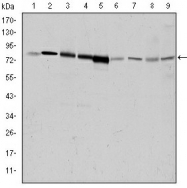 AM06612SU-N - Beta-ARK-1 / ADRBK1