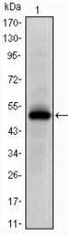 AM06621SU-N - EPHA10