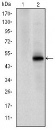 AM06623SU-N - CDK9