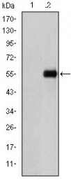 AM06633SU-N - CD105 / Endoglin