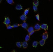 AM06633SU-N - CD105 / Endoglin