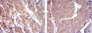 AM06640SU-N - HSP90AB1 / HSP90 beta
