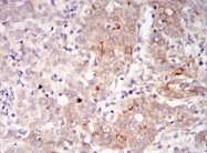 AM06644SU-N - B-cell linker protein / BLNK