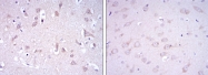 AM06645SU-N - Glutamate receptor 3 / GLUR3