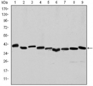 AM06647SU-N - ACTA2 / aortic smooth muscle Actin