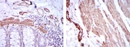AM06647SU-N - ACTA2 / aortic smooth muscle Actin