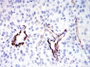 AM06651SU-N - DLGAP1 / SAPAP1