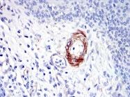 AM06651SU-N - DLGAP1 / SAPAP1