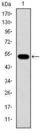 AM06654SU-N - Glucokinase / Hexokinase-4