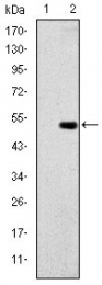 AM06654SU-N - Glucokinase / Hexokinase-4