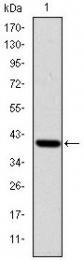 AM06655SU-N - Tyrosine-protein kinase ITK/TSK