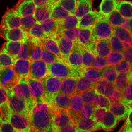 AM06660SU-N - Cytokeratin 19