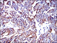 AM06660SU-N - Cytokeratin 19