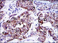 AM06660SU-N - Cytokeratin 19