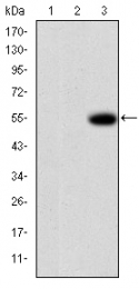 AM06662SU-N - MMP-9