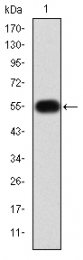 AM06664SU-N - MMP-9