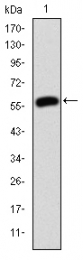 AM06681SU-N - Junction plakoglobin