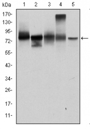 AM06681SU-N - Junction plakoglobin