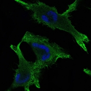 AM06681SU-N - Junction plakoglobin