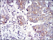 AM06681SU-N - Junction plakoglobin