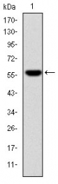 AM06682SU-N - Fibrinogen gamma chain