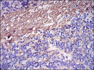 AM06682SU-N - Fibrinogen gamma chain