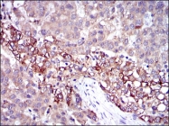 AM06682SU-N - Fibrinogen gamma chain