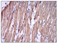 AM06686SU-N - Fast skeletal muscle Troponin I