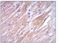 AM06686SU-N - Fast skeletal muscle Troponin I