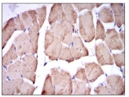 AM06686SU-N - Fast skeletal muscle Troponin I