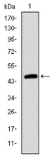 AM06686SU-N - Fast skeletal muscle Troponin I