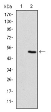 AM06686SU-N - Fast skeletal muscle Troponin I