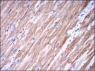 AM06688SU-N - Fast skeletal muscle Troponin I