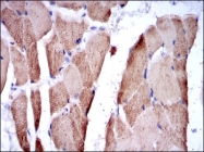 AM06688SU-N - Fast skeletal muscle Troponin I