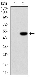 AM06692SU-N - Interleukin-1 beta / IL-1B