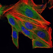 AM06692SU-N - Interleukin-1 beta / IL-1B