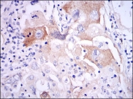 AM06692SU-N - Interleukin-1 beta / IL-1B