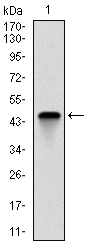 AM06710PU-N - Fast skeletal muscle Troponin I
