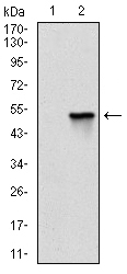 AM06710PU-N - Fast skeletal muscle Troponin I