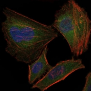 AM06710PU-N - Fast skeletal muscle Troponin I