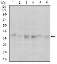 AM06712SU-N - PPP1CA