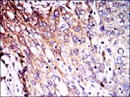 AM06714PU-N - Neurofilament L (68kDa)