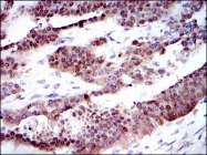AM06716PU-N - CYP1A1